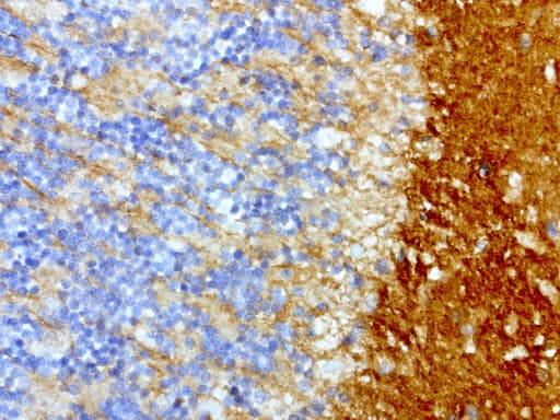 Monoclonal Mouse anti-Human L1CAM Antibody (clone UMAB48, IHC, IF, WB)