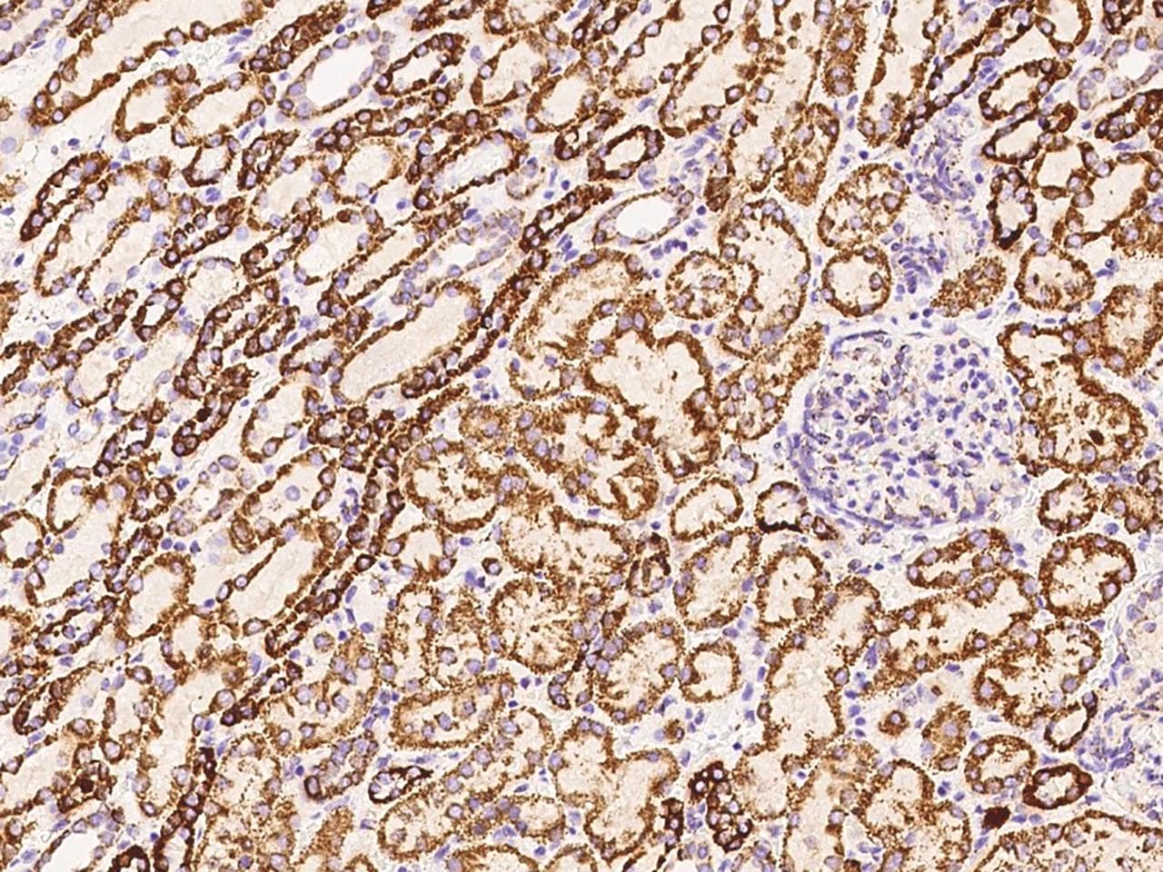 DLAT / PDC-E2 Antibody (Preservative Free)