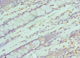 Polyclonal Rabbit anti-Human SF3B2 Antibody (aa616-895, IHC)