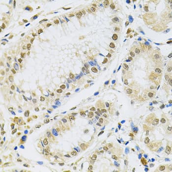 Polyclonal Rabbit anti-Human MCL1 / MCL 1 Antibody (IHC, IF, WB)