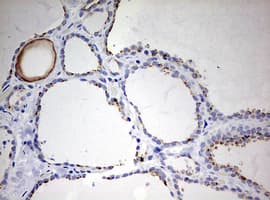 Monoclonal Mouse anti-Human KRT20 / CK20 / Cytokeratin 20 Antibody (clone OTI3G1, IHC, WB)