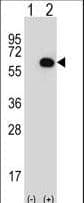 GK / Glycerol Kinase Antibody (aa24-51)