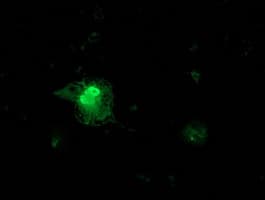 FGF21 Antibody (aa29-209, clone OTI2F8)
