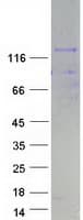 Human NFATC4 / NFAT3 Protein (Recombinant Myc-DDK (Flag))