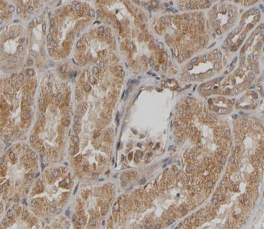 HSPB1 / HSP27 Antibody (phospho-Ser15)
