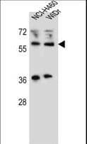 IHC-plus™ Polyclonal Rabbit anti-Human WTIP Antibody (aa243-271, IHC, IF, WB)