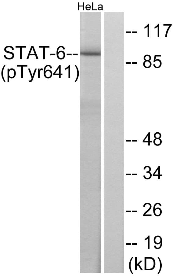 STAT6 Antibody (phospho-Tyr641)