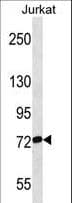 RPAP3 / FLJ21908 Antibody (aa311-338)