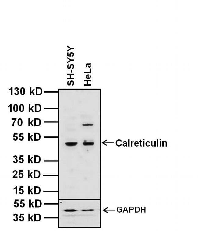 Monoclonal Mouse anti-Human CALR / Calreticulin Antibody (clone 1G6A7, EEEDVPGQAKDELC, IHC, IF, WB)