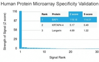 BAP1 Antibody (clone BAP1/2431)