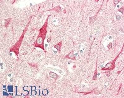 IHC-plus™ Polyclonal Rabbit anti-Human TMPRSS2 / Epitheliasin Antibody (aa100-470, IHC, WB)