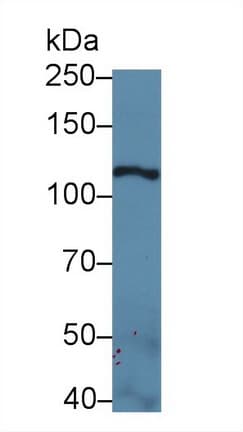 LAMC2 / Laminin Gamma 2 Antibody (aa28-196, APC)