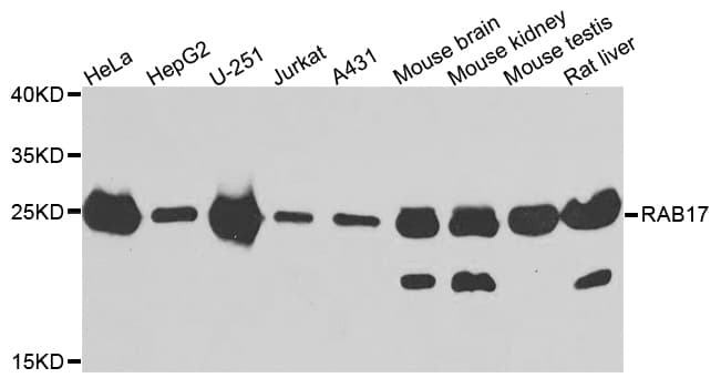Polyclonal Rabbit anti-Human RAB17 Antibody (IHC, WB)