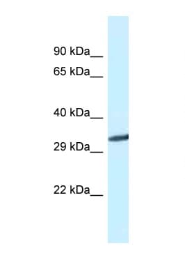 Polyclonal Rabbit anti-Mouse GNMT Antibody (C-Terminus, WB)
