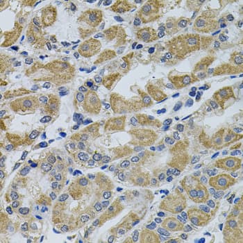Polyclonal Rabbit anti-Human CCK4 / PTK7 Antibody (IHC, WB)