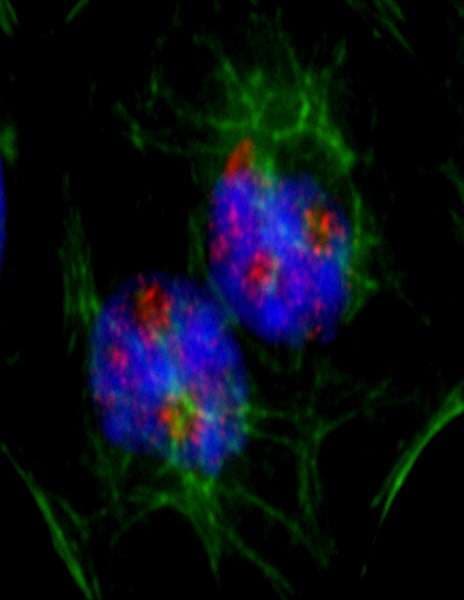 Polyclonal Rabbit anti-Human CD3EAP Antibody (aa404-454, IHC, IF)