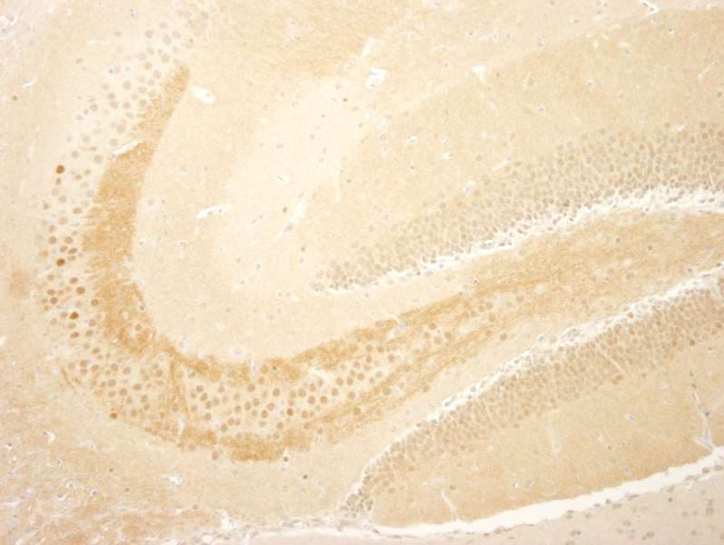 Polyclonal Rabbit anti-Human CRTC1 / MECT1 / TORC1 Antibody (aa600-C-term, IHC)