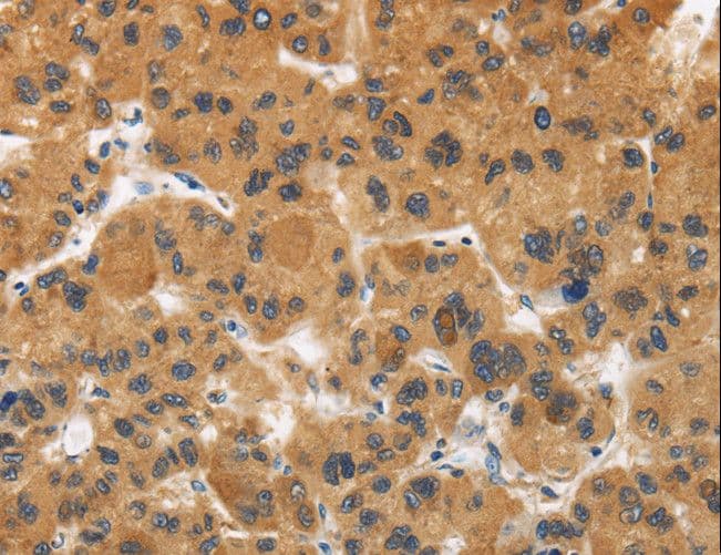 Polyclonal Rabbit anti-Human CALU / Calumenin Antibody (IHC)