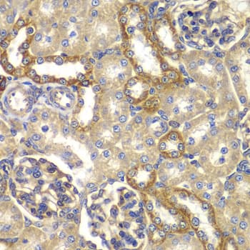 Polyclonal Rabbit anti-Human RAB5C Antibody (IHC, WB)
