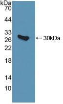 QDPR / DHPR Antibody (aa1-244, APC)