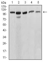Monoclonal Mouse anti-Human ATP2A1 / SERCA1 Antibody (clone 3D1H6, WB)