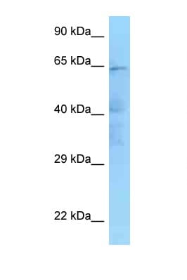 IKBKE / IKKI / IKKE Antibody (aa158-207)