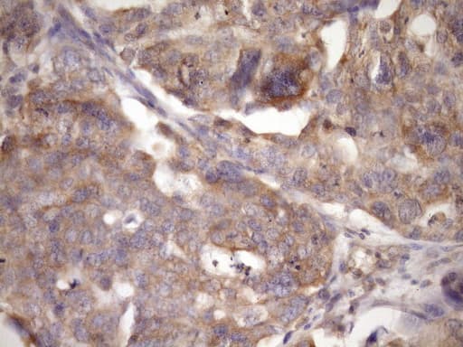 TARBP2 / TRBP2 Antibody (clone OTI7C1)