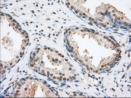 ERIC-1 / TACC3 Antibody (clone OTI6C6)