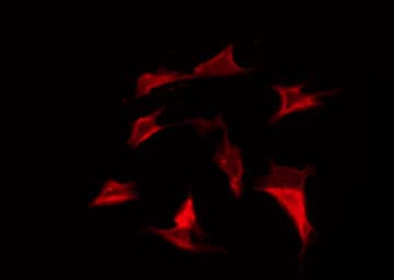 Polyclonal Rabbit anti-Human KCNJ4 / Kir2.3 Antibody (IF, WB)