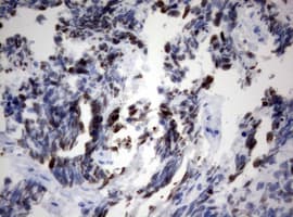 MKI67 / Ki67 Antibody (aa1160-1493, clone OTI15A4)