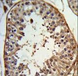 ANGEL1 Antibody (aa597-624)