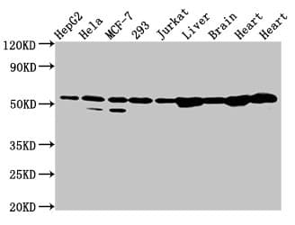 Polyclonal Rabbit anti-Human DLD / Diaphorase / E3 Antibody (IHC, WB)