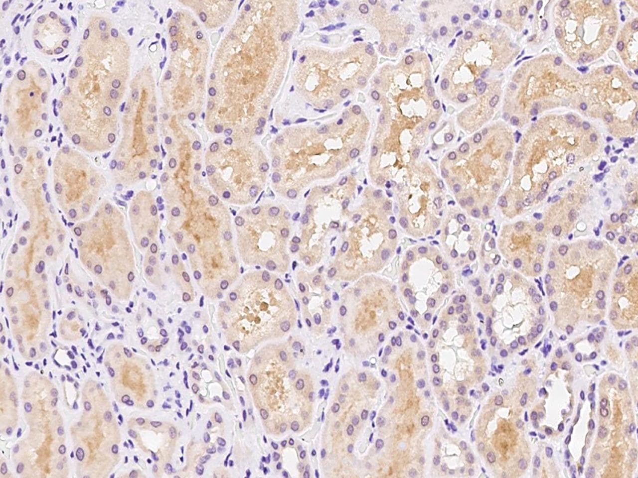 Polyclonal Rabbit anti-Human DIS3L Antibody (IHC)