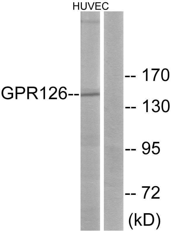 Polyclonal Rabbit anti-Human ADGRG6 / GPR126 Antibody (WB)