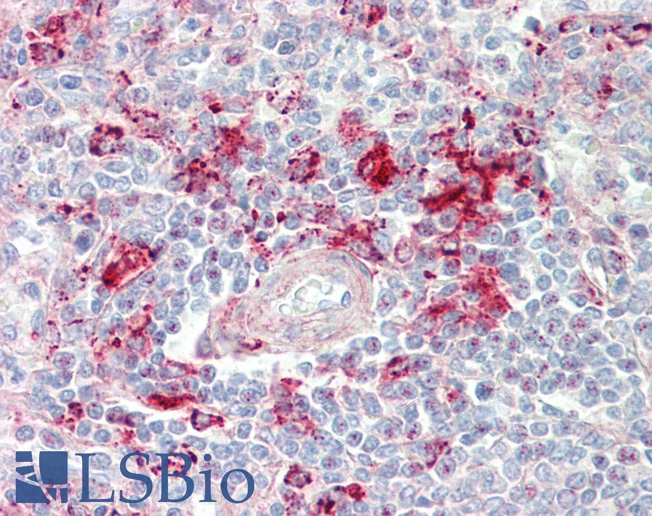 IHC-plus™ MCF2L / DBS Antibody (aa1049-1075)