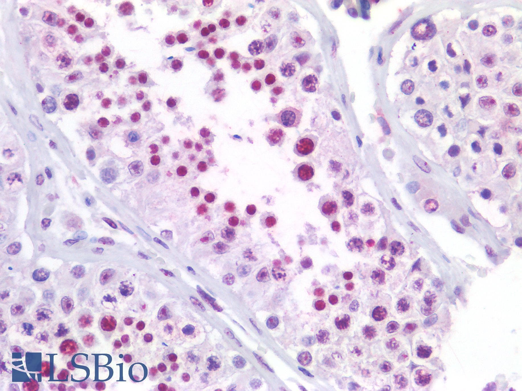 PathPlus™ NPM1 / NPM / Nucleophosmin Antibody
