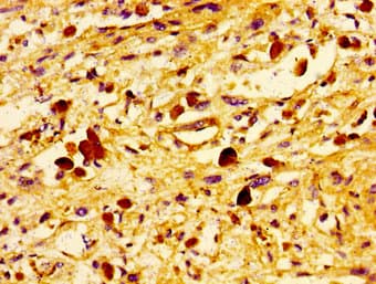 UBE2D2 / UBCH5B Antibody