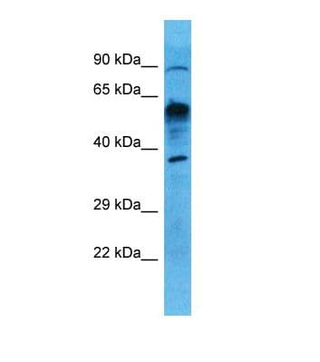 Polyclonal Rabbit anti-Human UXS1 Antibody (N-Terminus, WB)