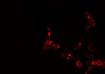 ATXN2L Antibody