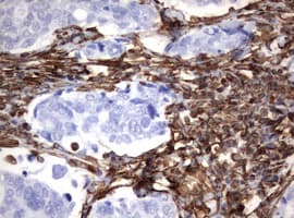 Vimentin Antibody (clone OTI1A9)
