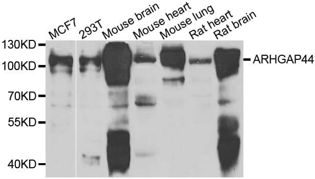 ARHGAP44 Antibody (AP)