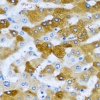 Polyclonal Rabbit anti-Human HAGH Antibody (IHC, IF, WB)