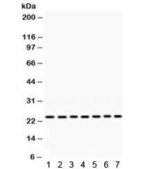 Polyclonal Rabbit anti-Human RALA / RAL Antibody (WB)