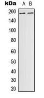 Polyclonal Rabbit anti-Human DCC Antibody (Internal, WB)