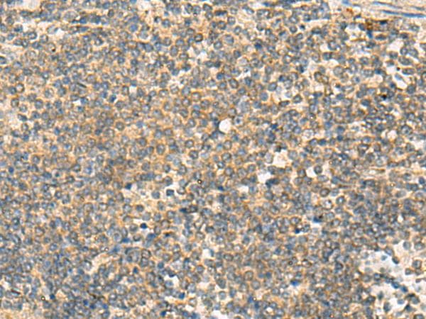Polyclonal Rabbit anti-Human PAFAH1B3 Antibody (IHC, WB)
