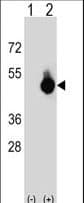 Polyclonal Rabbit anti-Human GPANK1 / G5 Antibody (aa275-302, IHC, WB)