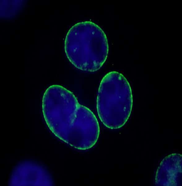 IHC-plus™ TPR Antibody (aa2300-C-term)