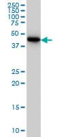 CRTAP Antibody (clone 4D9)