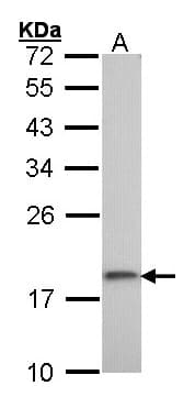 RPS10 / Ribosomal Protein S10 Antibody (aa1-151)
