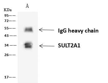 SULT2A1 / Sulfotransferase 2A1 Antibody
